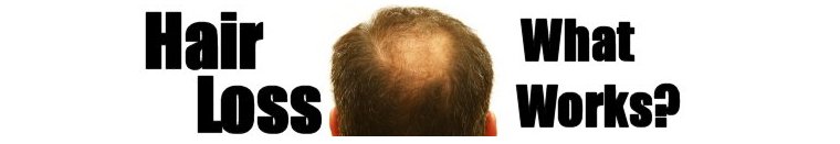 hair-loss-category.jpg